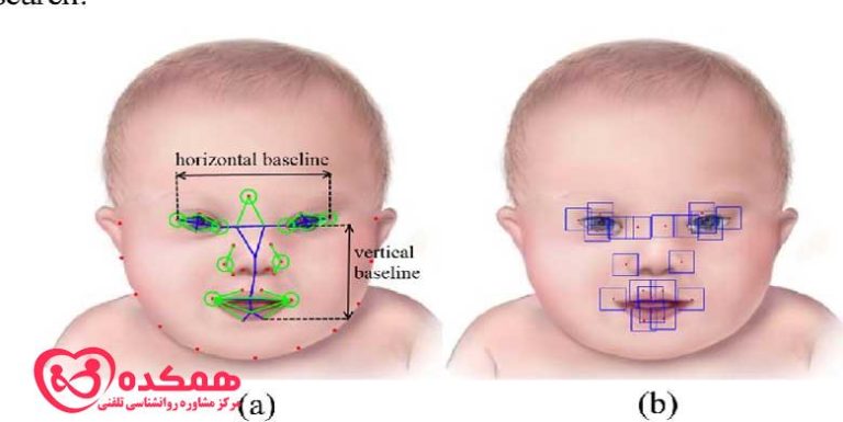 دیس مورفی بدن چیست و چگونه درمان می شود