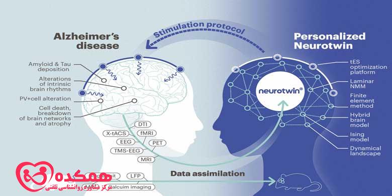 رایج ترین گزینه های درمانی آلزایمر