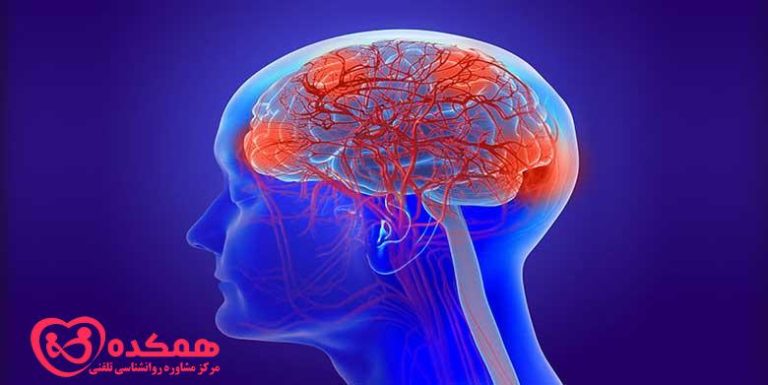 دمانس عروقی زیر قشر | همکده