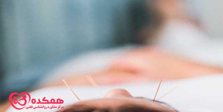 طب سوزنی | همکده