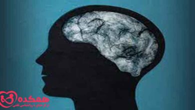 What is brain fog disorder in people?