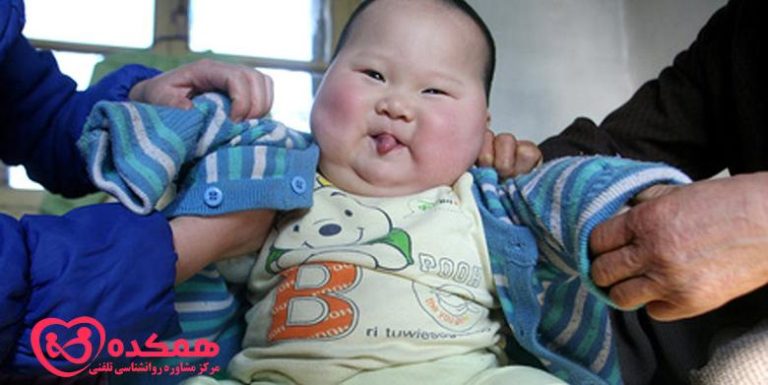 چاقی کودکان | همکده