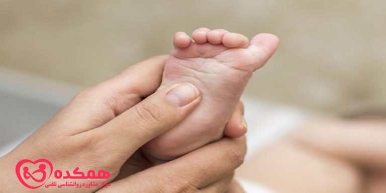 رفلکس بابینسکی - همکده