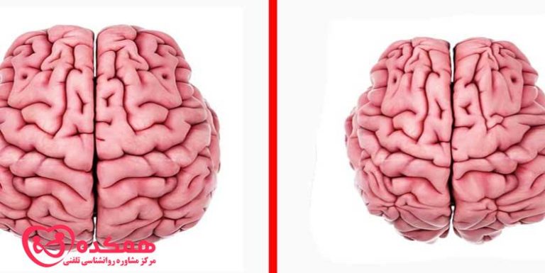 کوچک شدن مغز با استرس | همکده