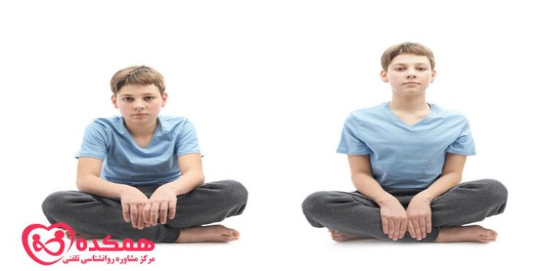 علل بدشکلی بدن در کودکی و بزرگسالی که هرگز نباید نادیده گرفت